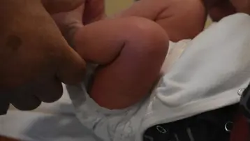 Sünnet edilen 27 günlük bebek öldü