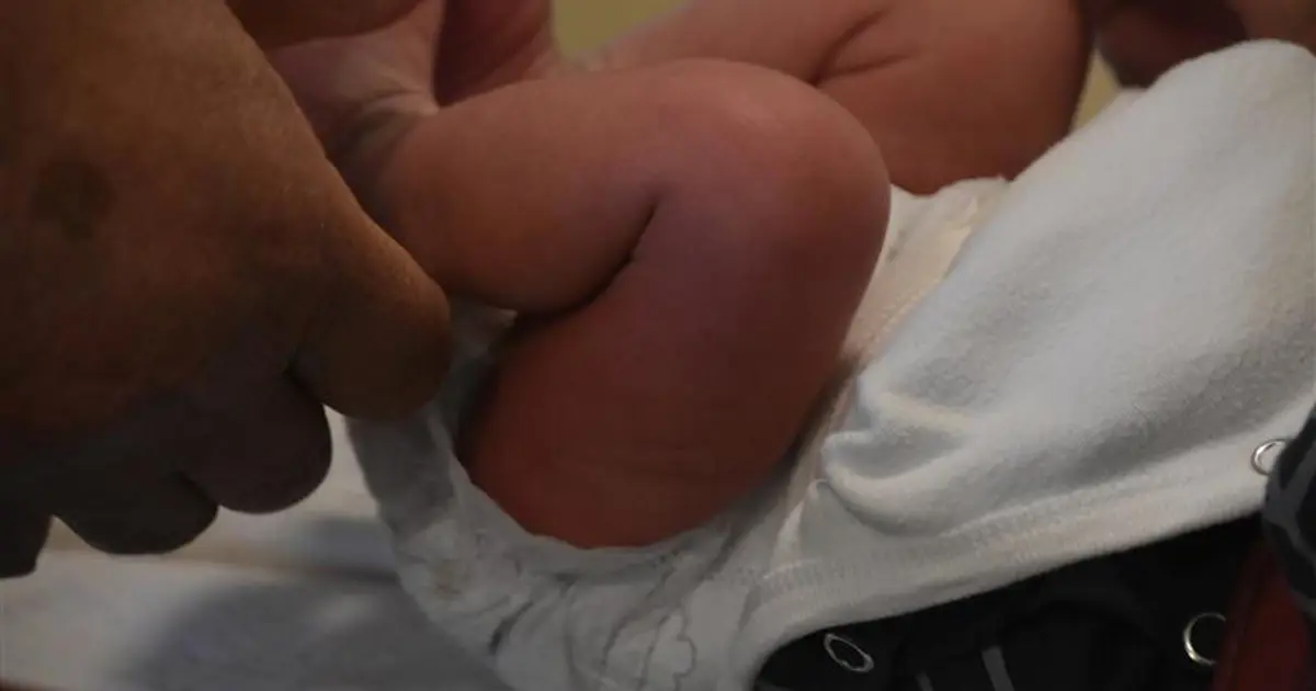 Sünnet edilen 27 günlük bebek öldü