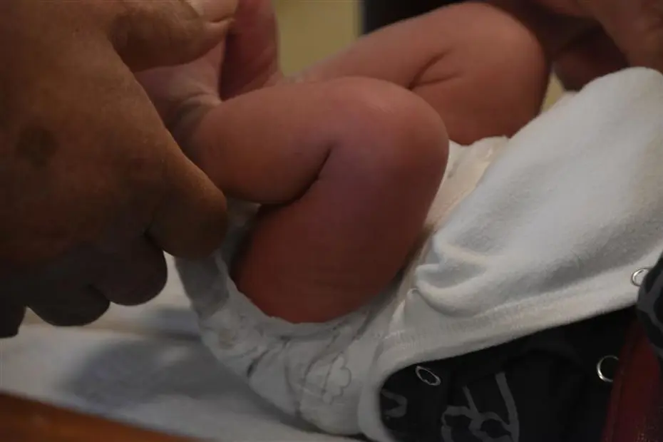 Sünnet edilen 27 günlük bebek öldü