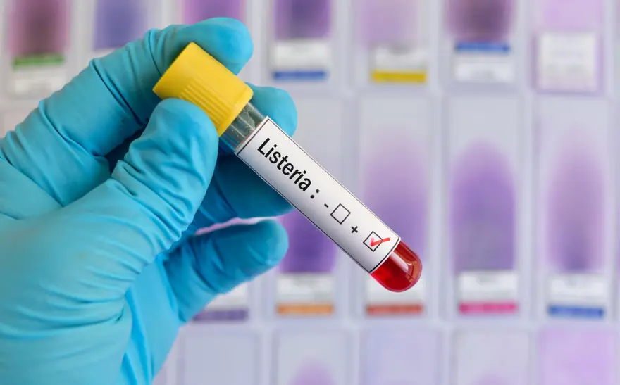 LISTERIA BELİRTİLERİ NELERDİR? 4