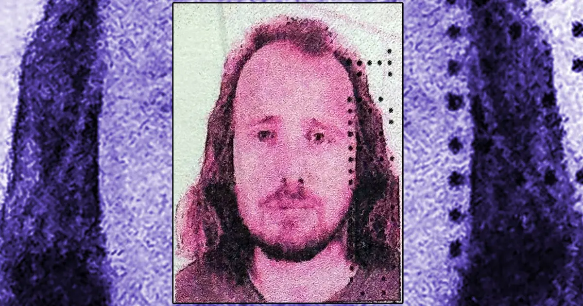 Saç ektirip, dişlerini yaptıran İngilizin ölümüne soruşturma