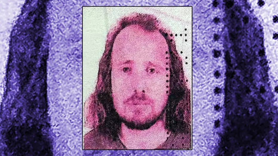 Saç ektirip, dişlerini yaptıran İngilizin ölümüne soruşturma