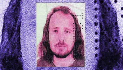 Saç ektirip, dişlerini yaptıran İngilizin ölümüne soruşturma