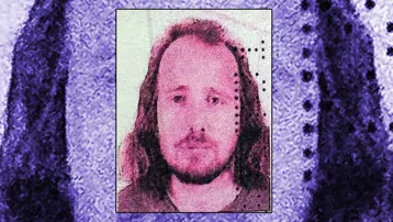 Saç ektirip, dişlerini yaptıran İngilizin ölümüne soruşturma