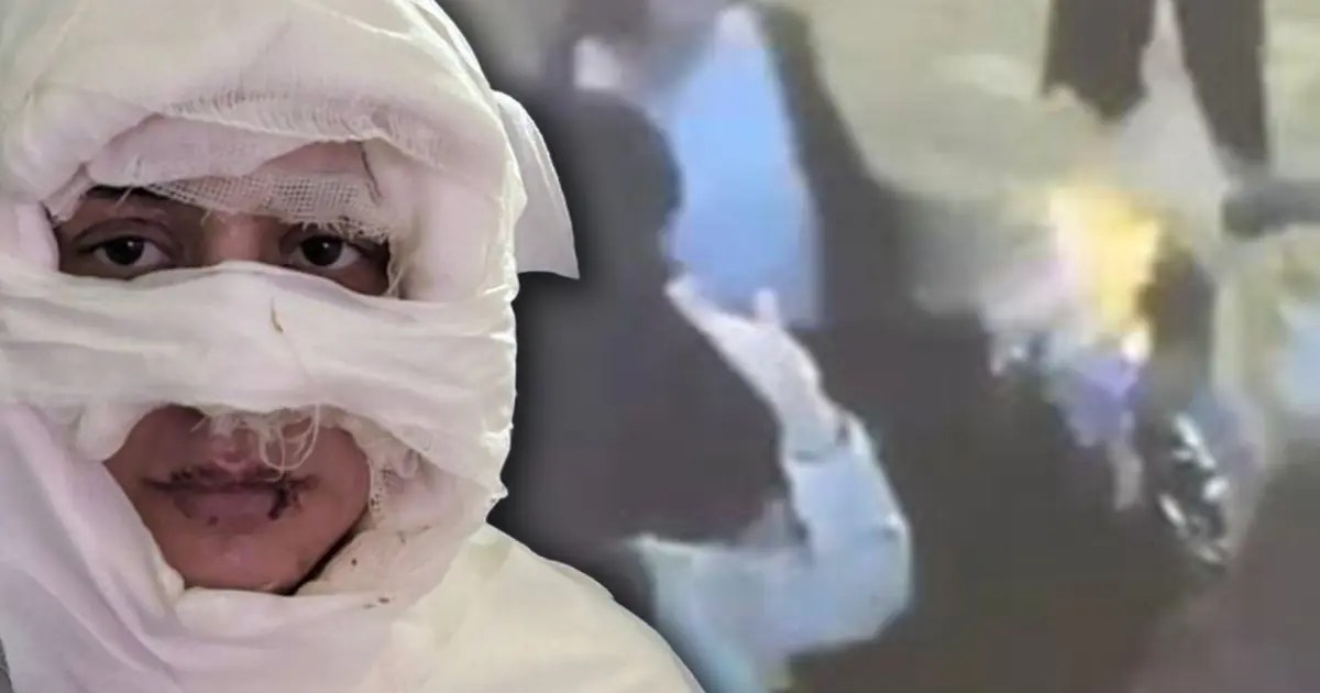 Kadıköy'de genç kadını kolonya döküp yaktı, istenen ceza belli oldu