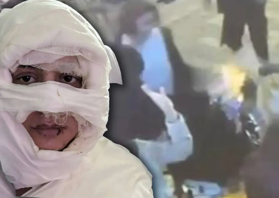 Kadıköy'de genç kadını kolonya döküp yaktı, istenen ceza belli oldu