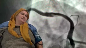 Milyonda bir görülen vaka. Öksürürken kalp damarı yırtıldı