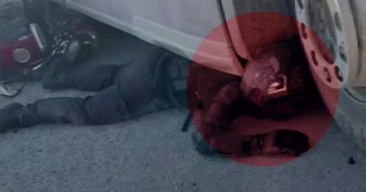 Sürüklenerek TIR'ın altına sıkıştı. Yaşadığı mucizeyi anlattı: Asfaltla burun burunaydım