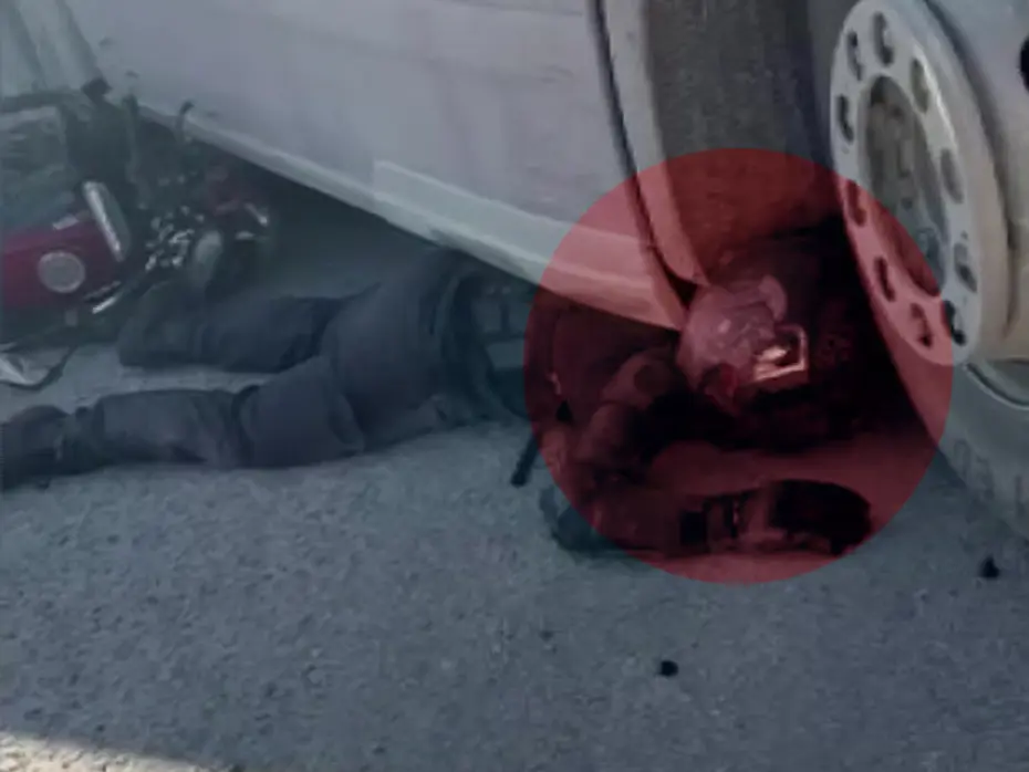 Sürüklenerek TIR'ın altına sıkıştı. Yaşadığı mucizeyi anlattı: Asfaltla burun burunaydım  