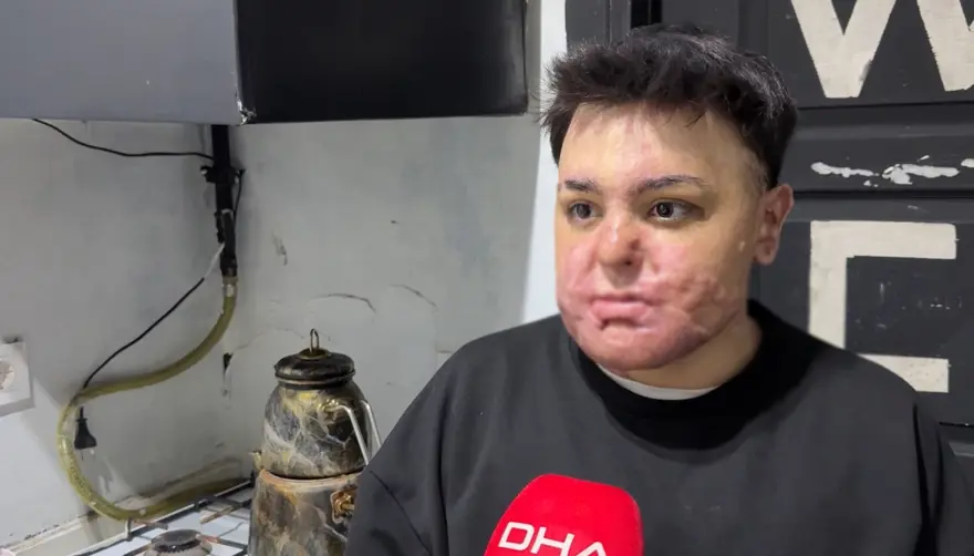 65 AMELİYAT GEÇİRDİ, 12 GÜN UYUTULDU 3