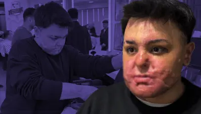 65 ameliyat geçirdi, 12 gün uyutuldu. Felaketi yaşadığı yerde şimdi çalışıyor