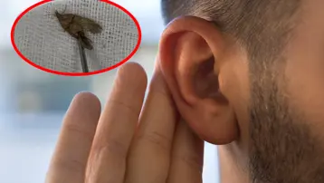 40 yaşındaki adamın kulağından çıktı. Hareketliydi, doğaya bırakıldı