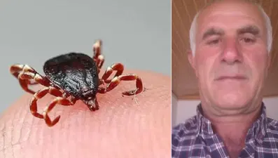 Vücuduna yapışan keneyi kendi çıkardı, 4 gün sonra öldü