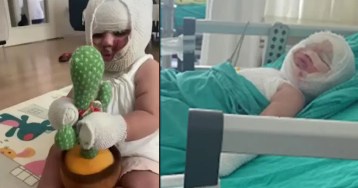 Domates konservesi bomba gibi patladı, 9 aylık bebeğin vücudu yandı
