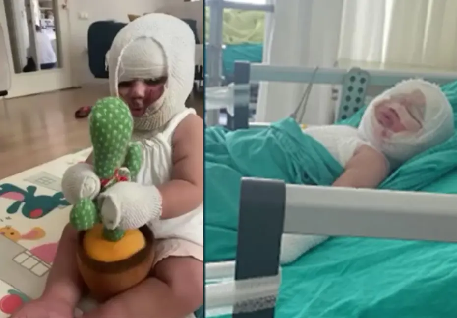 Domates konservesi bomba gibi patladı, 9 aylık bebeğin vücudu yandı