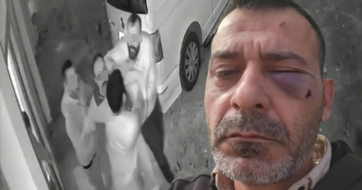 Kayseri'nin "Geppetto Ustası"na dayak