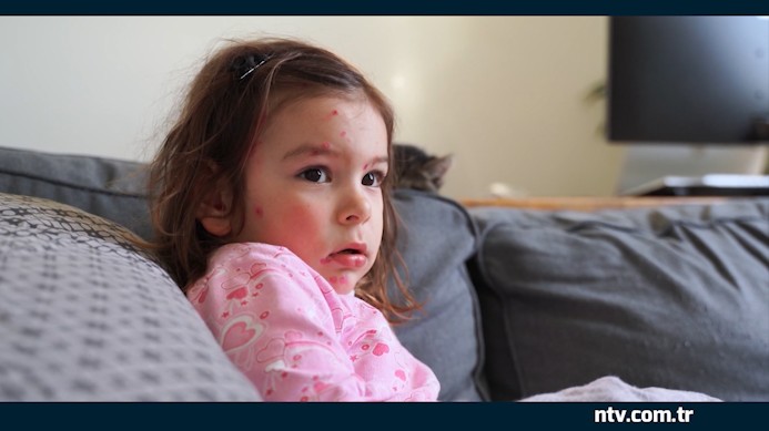 Unutulan hastalık geri mi dönüyor? İstanbul'da vaka sayılarında artış