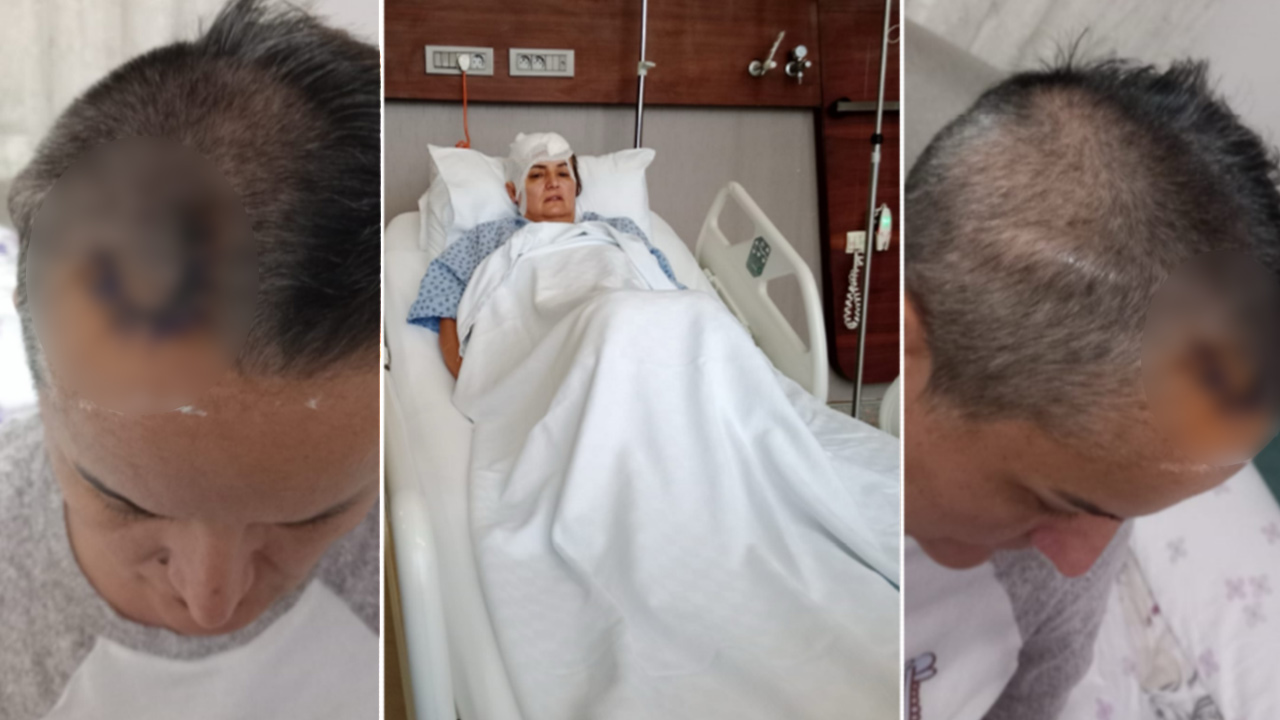 Diş ağrısı için gitti hayatı karardı. Şimdi beyninde ömür boyu cihazla yaşayacak