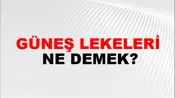 Güneş Lekeleri