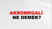 Akromegali