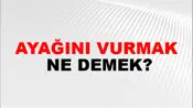 Ayağını Vurmak