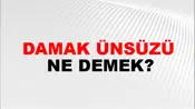 Damak Ünsüzü