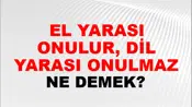 El Yarası Onulur, Dil Yarası Onulmaz