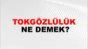 Tokgözlülük