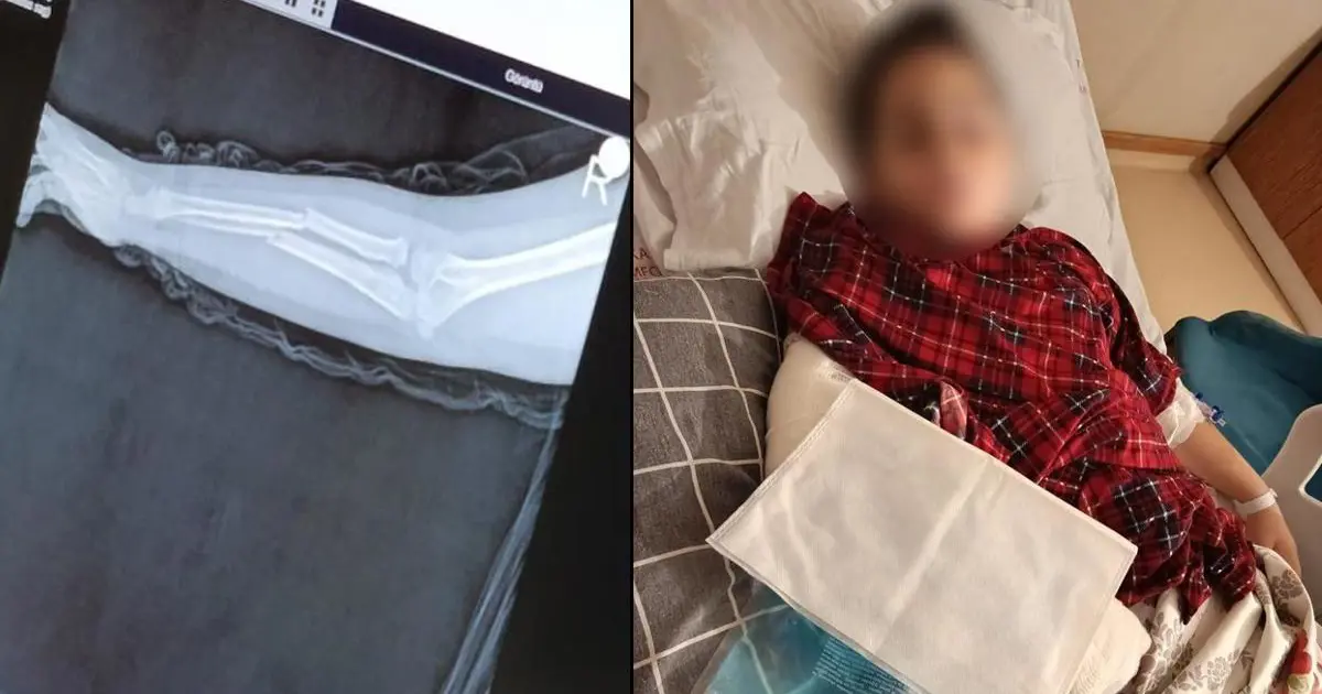 Okulda akran zorbalığı. 9 yaşındaki çocuk arkadaşının kolunu kırdı