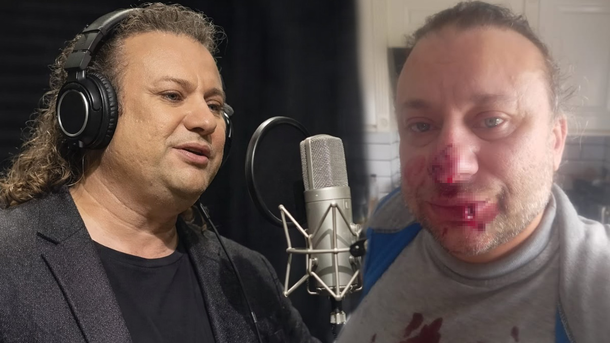 Ünlü sanatçı et yiyen bakteriyle savaşıyor