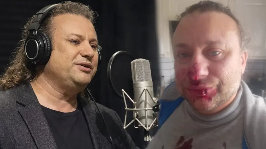  Ünlü sanatçı et yiyen bakteriyle savaşıyor