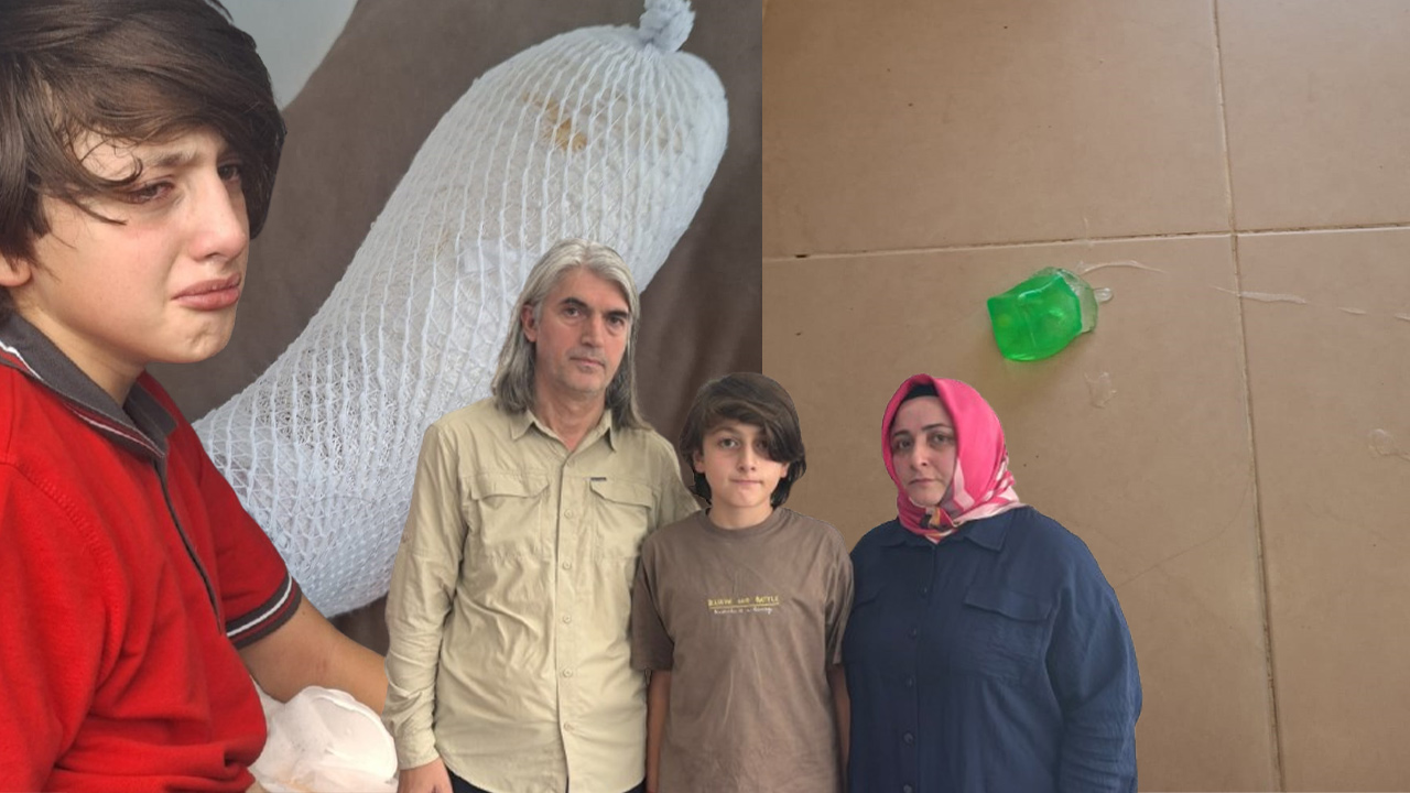 Alışveriş merkezinden aldıkları oyuncak elinde patladı.  "Dehşet verici bir sesle seslendi"