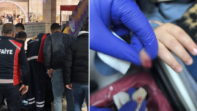 AVM'de feci olay. Yürüyen merdivene eli sıkışan çocuğun parmağı koptu