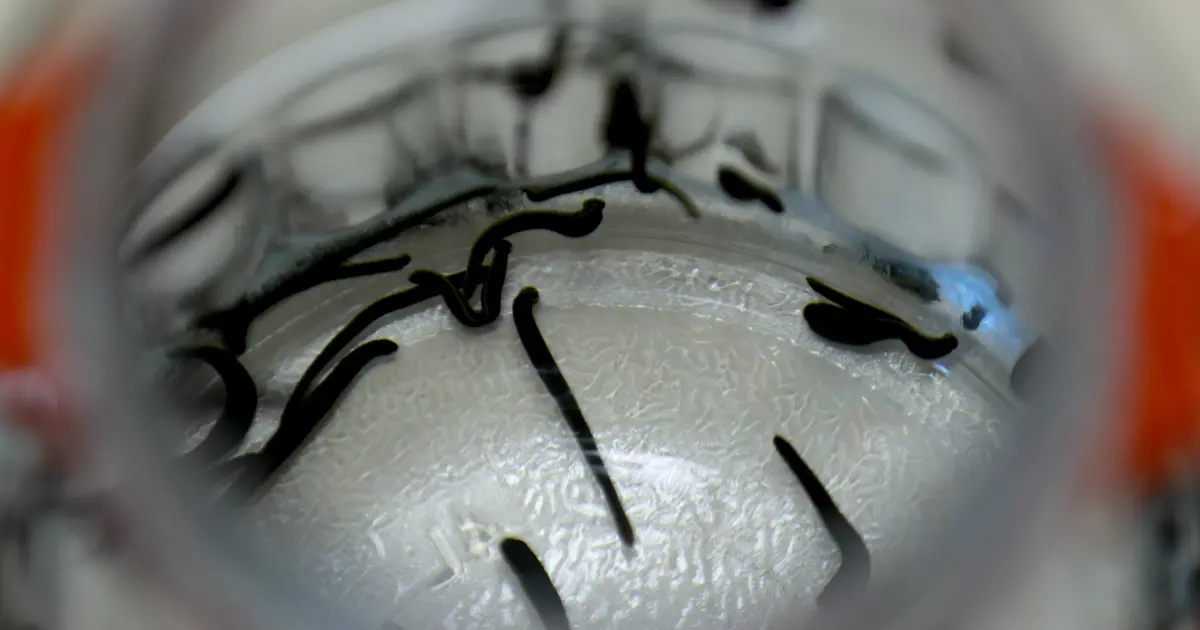 Hacamat, sülük, akupunktur... Bakanlık bünyesinde enstitü kuruldu, geleneksel tıp geliştirilecek