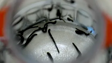 Hacamat, sülük, akupunktur... Bakanlık bünyesinde enstitü kuruldu, geleneksel tıp geliştirilecek