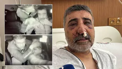 İngiliz boksörün öldüresiye dövdüğü taksici: "Geceleri bağırarak uyanıyorum"

