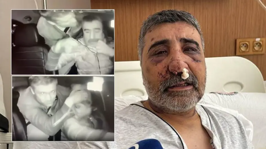 İngiliz boksörün öldüresiye dövdüğü taksici: 