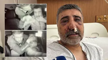 İngiliz boksörün öldüresiye dövdüğü taksici: "Geceleri bağırarak uyanıyorum"