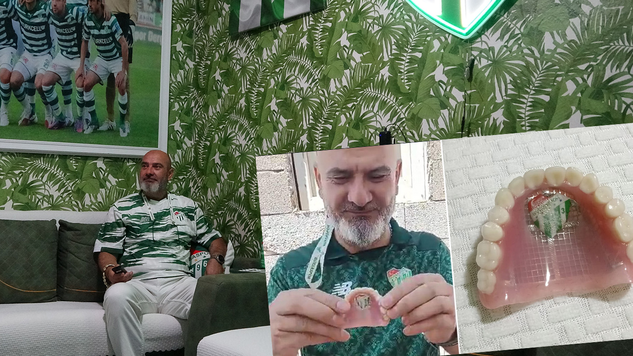 Görenler şoke oluyor, böyle taraftar görülmedi. Damağına Bursaspor arması yaptırdı