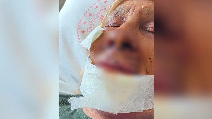 Şanlıurfa'da kan donduran olay. 85 yaşındaki annesini öldüresiye dövdü 2