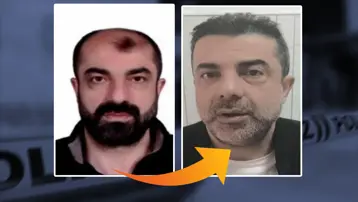 Ankara'da film gibi olay: Ameliyatla yüzünü değiştirip saç ektiren cinayet zanlısı yedi yıl sonra yakalandı