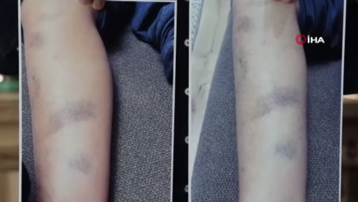 Diyarbakır'da özel okulda öğrenciye dayak iddiasına soruşturma